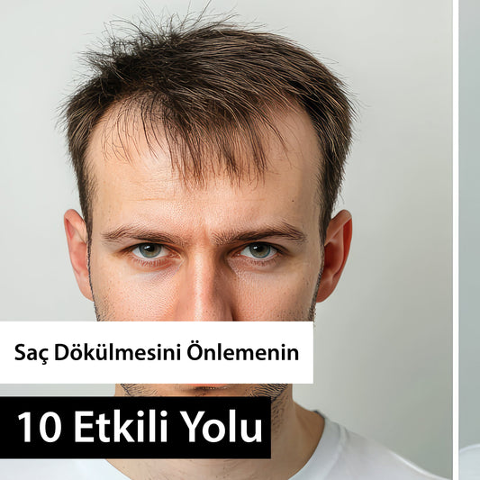 Saç Dökülmesini Önlemenin 10 Etkili Yolu