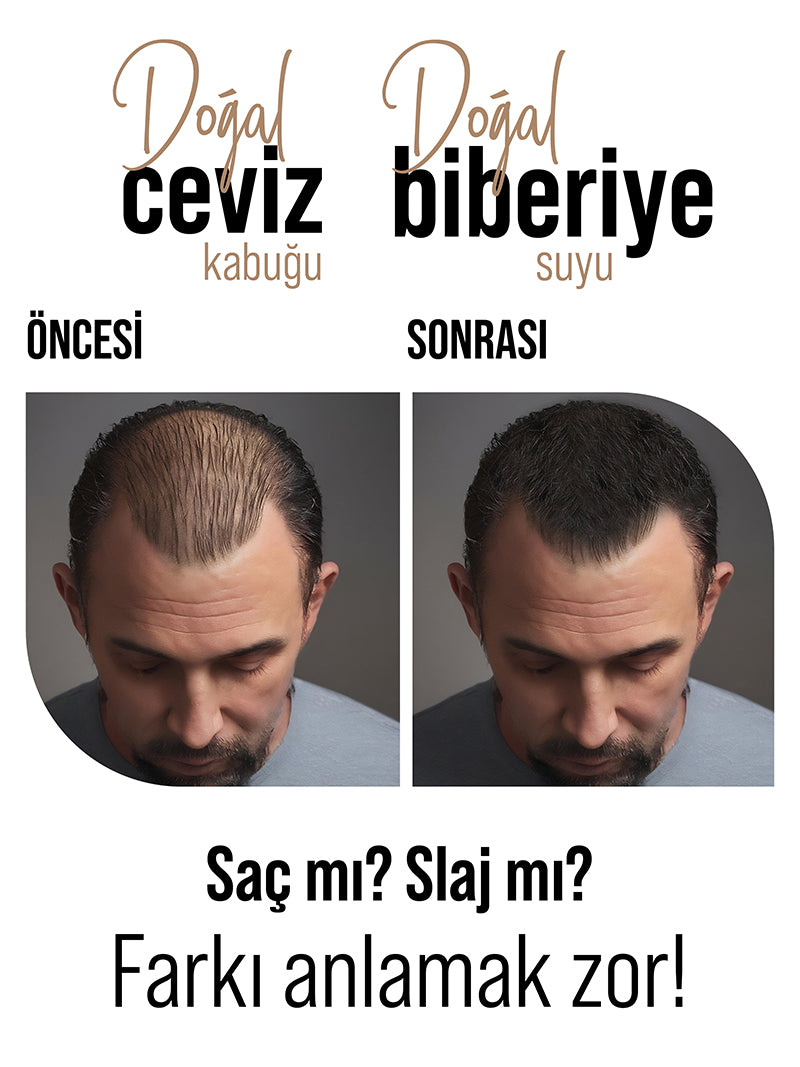 Saç Kapatıcı 10-15 Gün Kalıcı