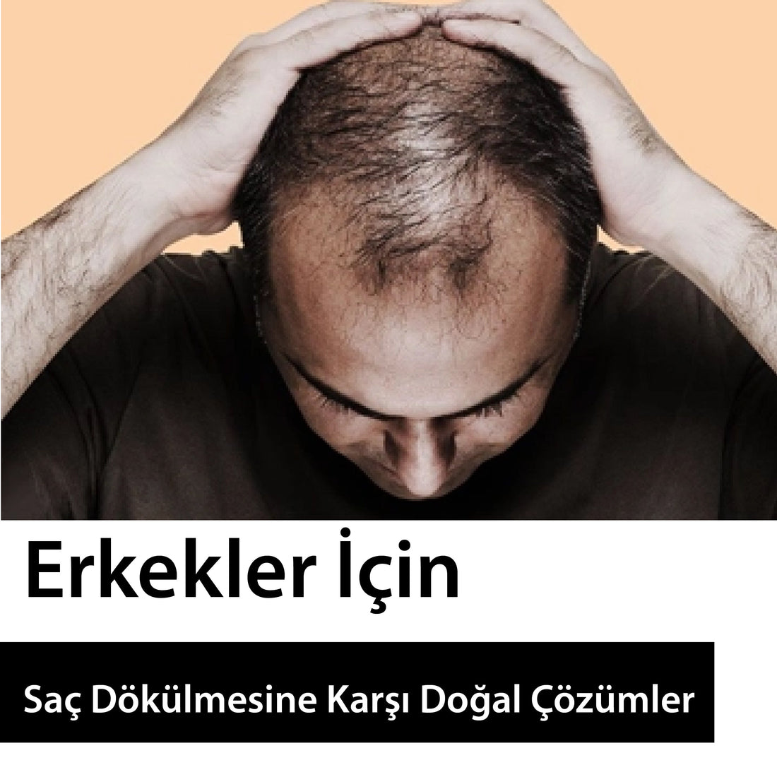 Erkekler İçin Saç Dökülmesine Karşı Doğal Çözümler