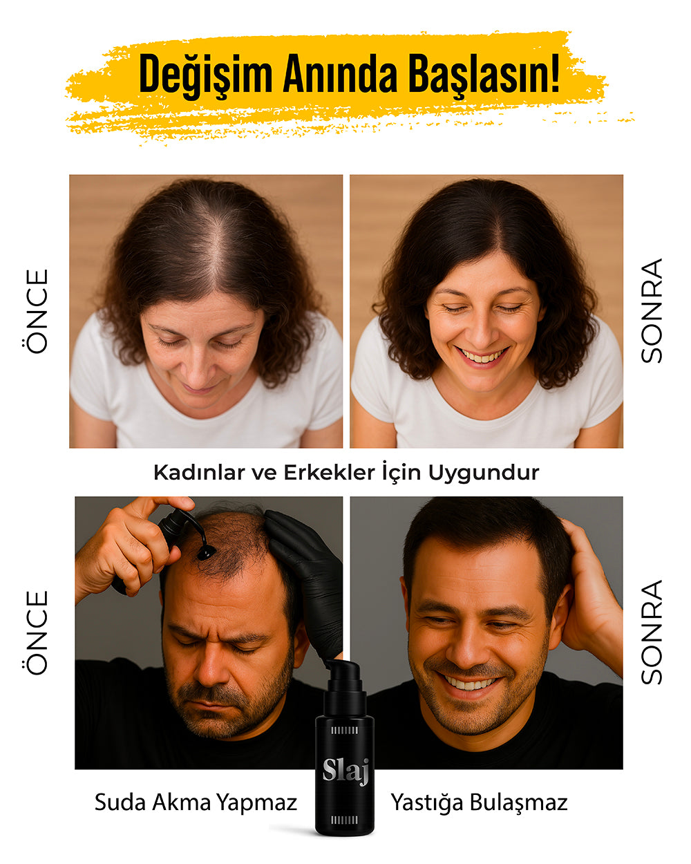 2 Kutu Slaj Saç Kapatıcı