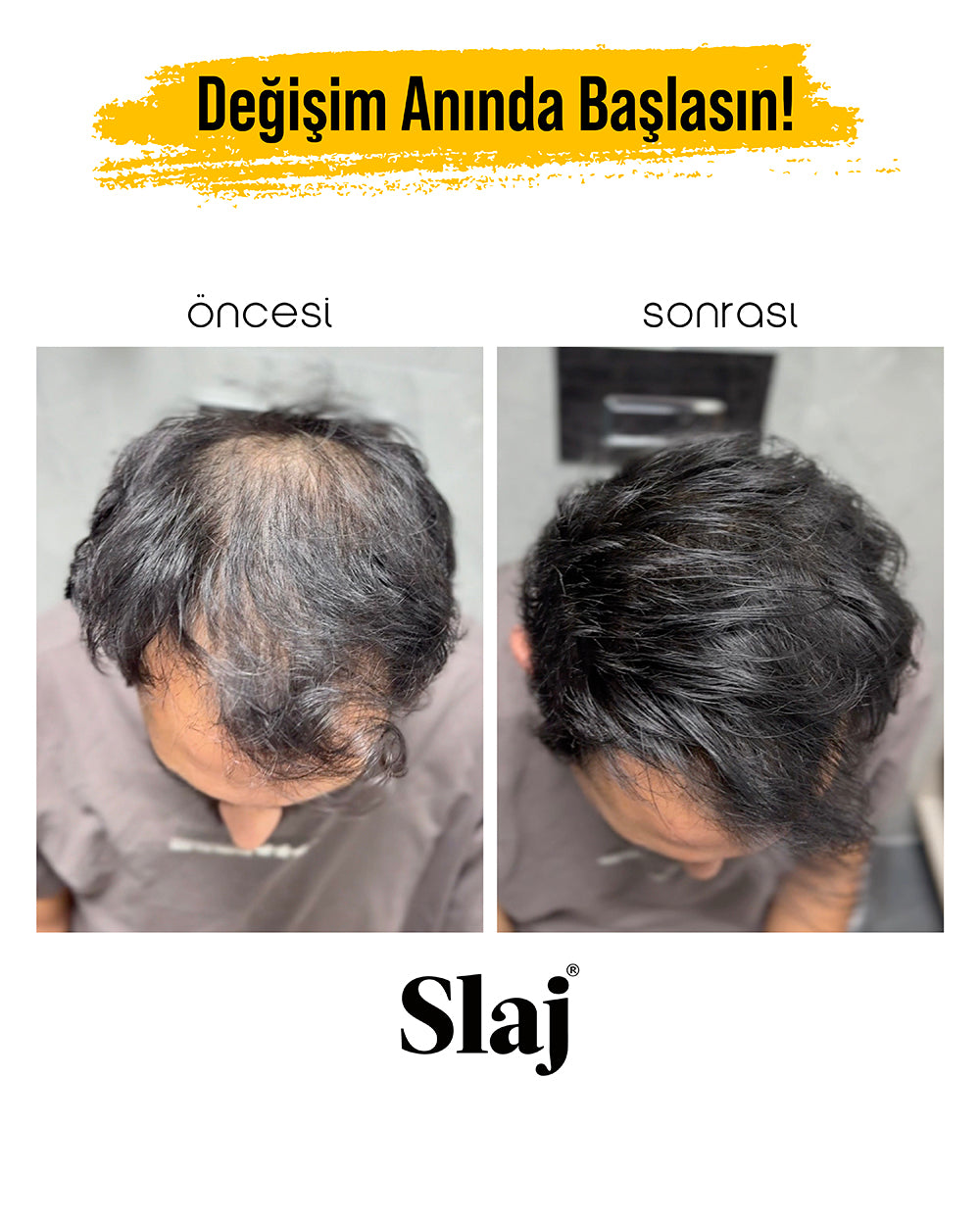 2 Kutu Slaj Saç Kapatıcı