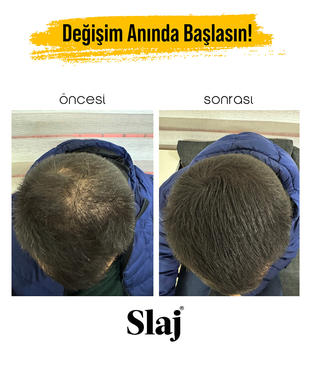 2 Kutu Slaj Saç Kapatıcı