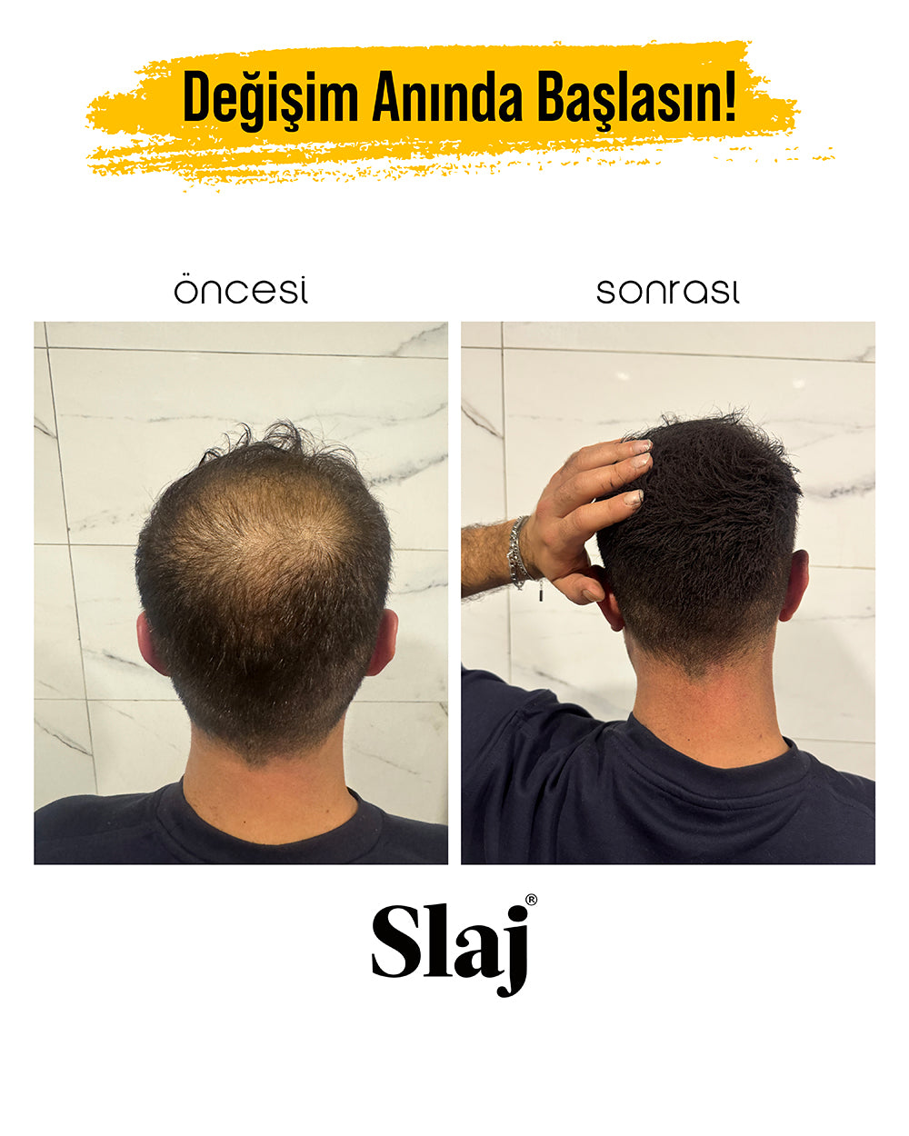 4 Kutu Slaj Saç Kapatıcı