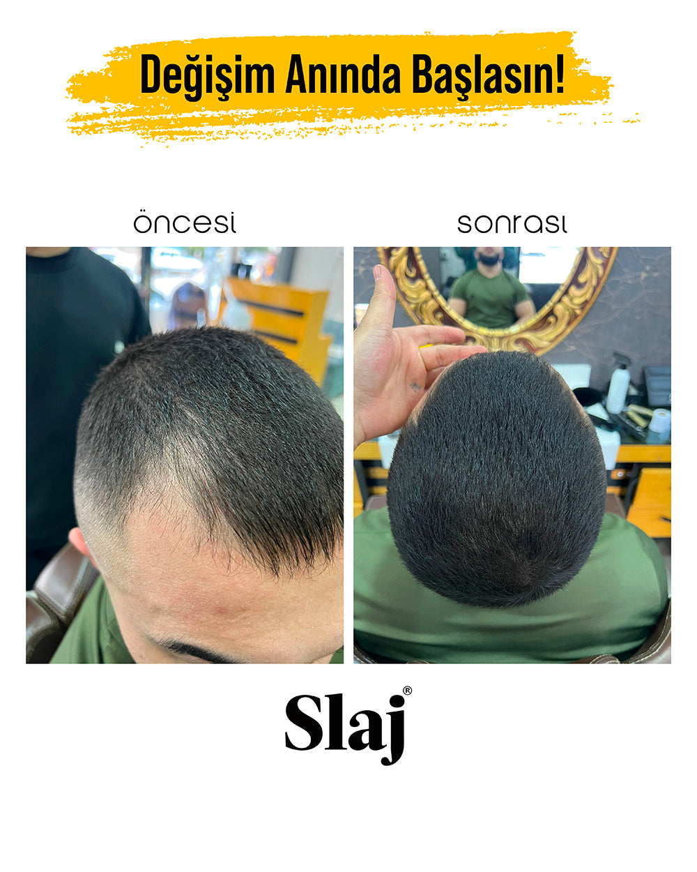 2 Kutu Slaj Saç Kapatıcı